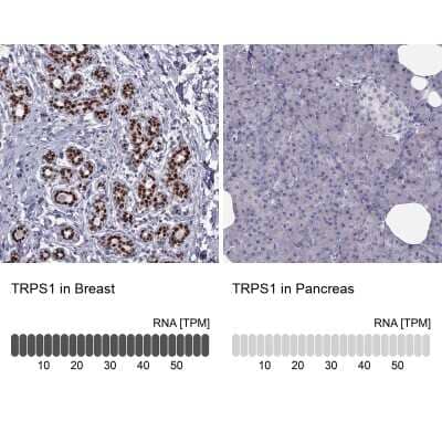 Immunohistochemistry-Paraffin: TRPS1 Antibody [NBP2-62672]