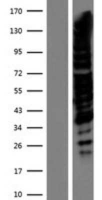 Western Blot: TRPS1 Overexpression Lysate [NBP2-07380]