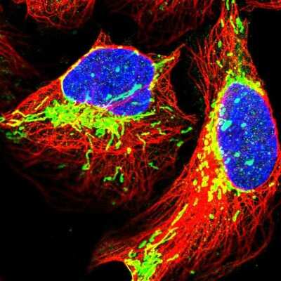 Immunocytochemistry/ Immunofluorescence: TRPT1 Antibody [NBP2-32642]