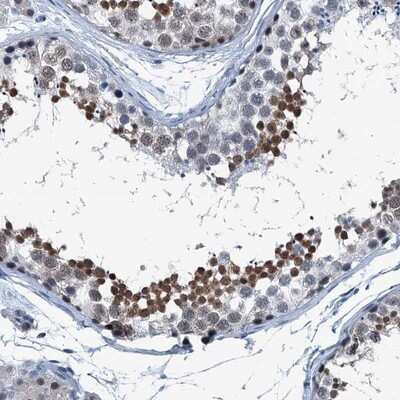Immunohistochemistry-Paraffin: TRPT1 Antibody [NBP1-81230]