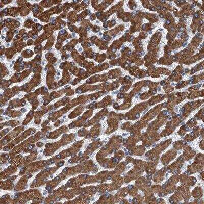 Immunohistochemistry-Paraffin: TRPT1 Antibody [NBP2-32642]