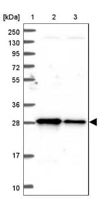 Western Blot: TRPT1 Antibody [NBP1-81230]