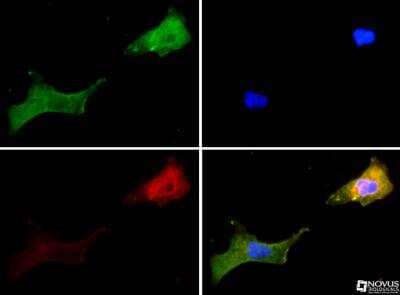 Immunocytochemistry/ Immunofluorescence: Vanilloid R1/TRPV1 Antibody - BSA Free [NBP1-97417]