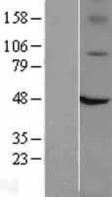 Western Blot: Vanilloid R1/TRPV1 Overexpression Lysate [NBL1-17340]