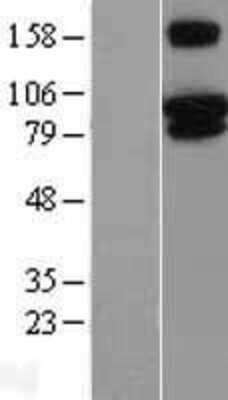 Western Blot: Vanilloid R-like 3/TRPV3 Overexpression Lysate [NBL1-17342]