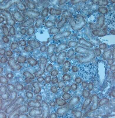 Immunohistochemistry-Paraffin: TRPV4 Antibody - Azide and BSA Free [NBP1-20225]