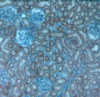 Immunohistochemistry-Paraffin: TRPV4 Antibody - Azide and BSA Free [NBP1-20225]