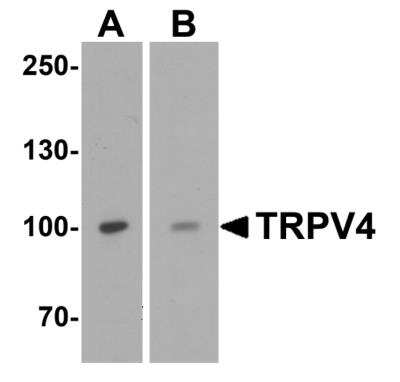 Western Blot: TRPV4 AntibodyBSA Free [NBP2-41262]