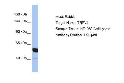 Western Blot: TRPV4 Antibody [NBP2-82365]