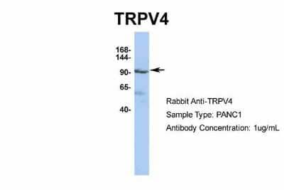 Western Blot: TRPV4 Antibody [NBP2-82366]