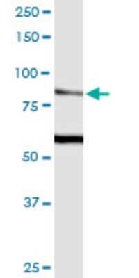 Western Blot: TRPV5 Antibody (2A6) [H00056302-M02]