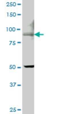 Western Blot: TRPV5 Antibody (6D6) [H00056302-M06]