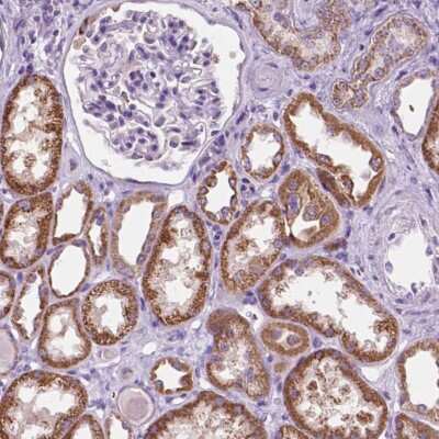 Immunohistochemistry-Paraffin: TRPV5 Antibody [NBP2-49386]