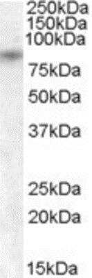 Western Blot: TRPV5 Antibody [NB100-93520]