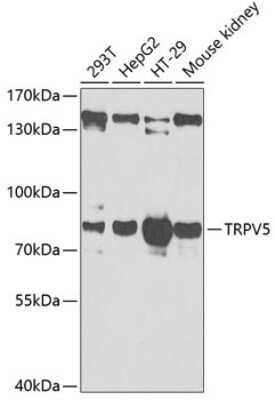 Western Blot: TRPV5 AntibodyBSA Free [NBP2-94490]