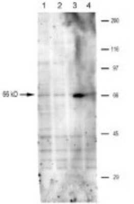 Western Blot: TRPV6 Antibody [NBP1-74138]