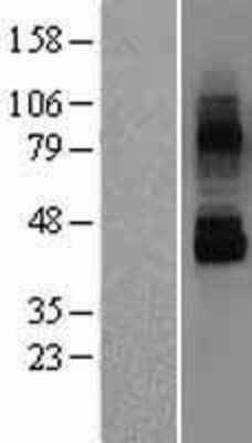 Western Blot: TRPV6 Overexpression Lysate [NBL1-17345]