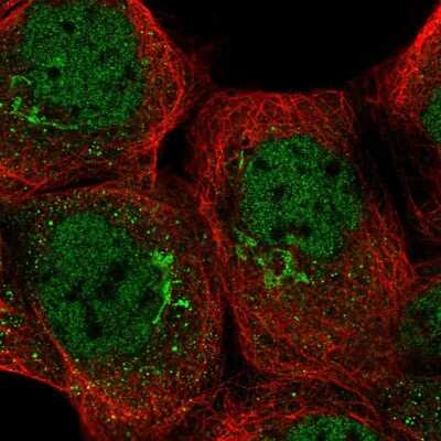 Immunocytochemistry/ Immunofluorescence: TRRAP Antibody [NBP2-58076]