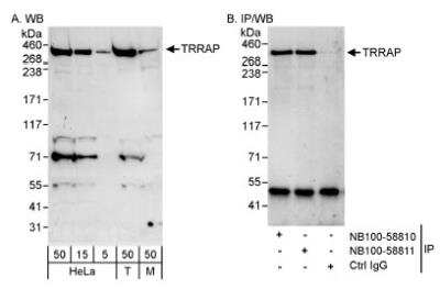 Western Blot: TRRAP Antibody [NB100-58811]