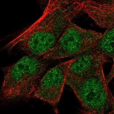 Immunocytochemistry/ Immunofluorescence: TRSPAP1 Antibody [NBP2-58500]