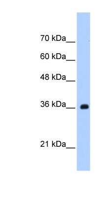 Western Blot: TRSPAP1 Antibody [NBP1-57445]