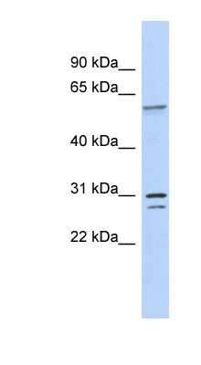 Western Blot: TRSPAP1 Antibody [NBP1-57446]