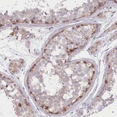 Immunohistochemistry-Paraffin: TRUB1 Antibody [NBP1-80866]