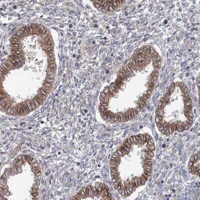 Immunohistochemistry-Paraffin: TRUB1 Antibody [NBP1-80866]