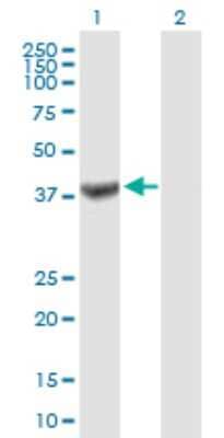 Western Blot: TRUB1 Antibody [H00142940-B01P]