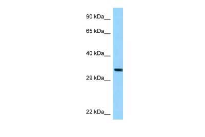 Western Blot: TRUB1 Antibody [NBP2-88495]