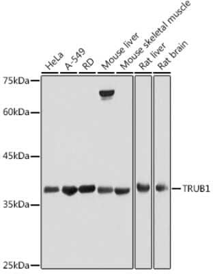 Western Blot: TRUB1 AntibodyAzide and BSA Free [NBP3-16027]