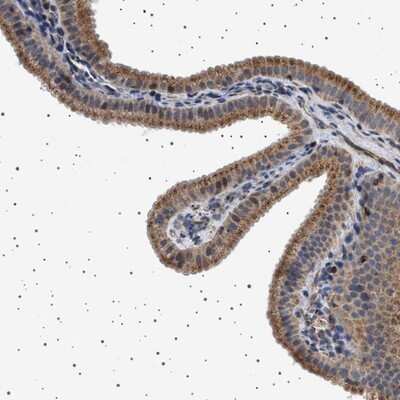 Immunohistochemistry-Paraffin: TRUB2 Antibody [NBP1-85560]