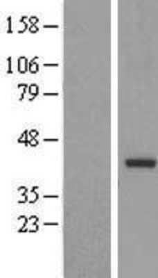 Western Blot: TRUB2 Overexpression Lysate [NBL1-17348]