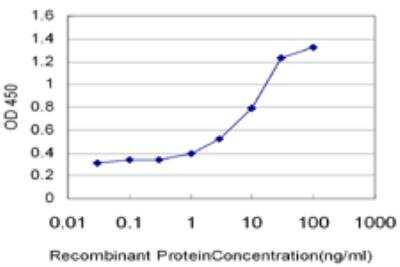 ELISA: TRUSS Antibody (3G4) [H00026133-M07]