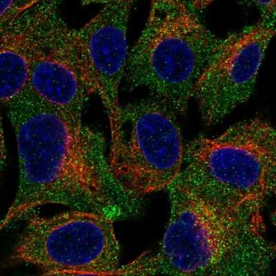 Immunocytochemistry/ Immunofluorescence: TRUSS Antibody [NBP2-57776]