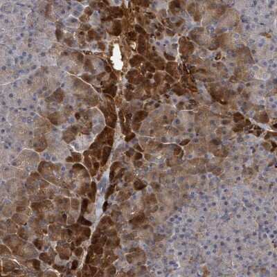 Immunohistochemistry: TRUSS Antibody [NBP2-47593]