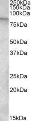 Western Blot: TRUSS Antibody [NBP1-45204]