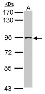 Western Blot: TRUSS Antibody [NBP2-20741]