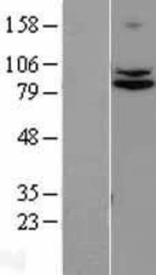 Western Blot: TRUSS Overexpression Lysate [NBL1-17333]