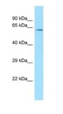 Western Blot: TRXR3 Antibody [NBP1-98287]