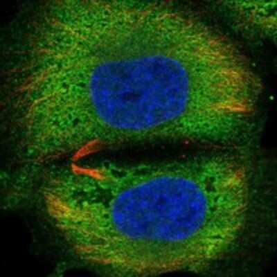 Immunocytochemistry/ Immunofluorescence: TSBP Antibody [NBP3-17554]