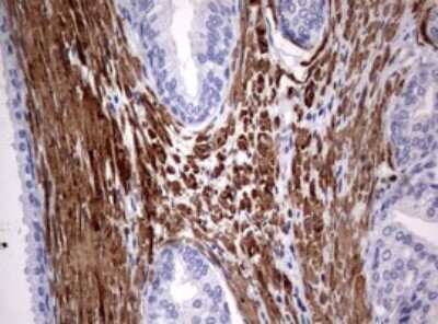 Immunohistochemistry: TSC1 Antibody (OTI3A2) [NBP2-46234]