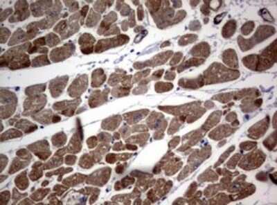 Immunohistochemistry: TSC1 Antibody (OTI3A2) [NBP2-46234]