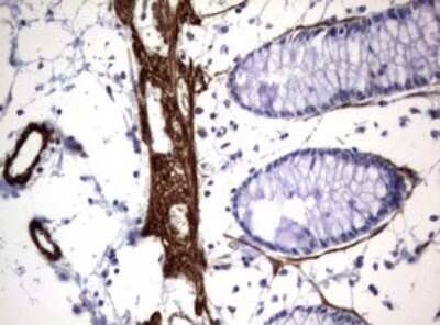 Immunohistochemistry: TSC1 Antibody (OTI3A2) [NBP2-46234]