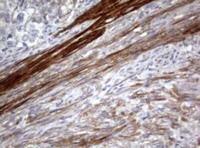 Immunohistochemistry: TSC1 Antibody (OTI3A2) [NBP2-46234]