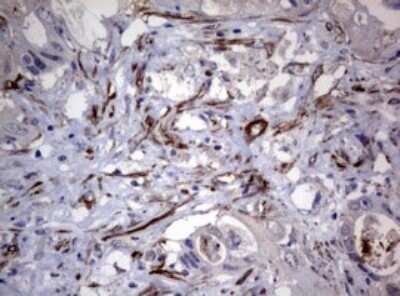 Immunohistochemistry: TSC1 Antibody (OTI3A2) [NBP2-46234]