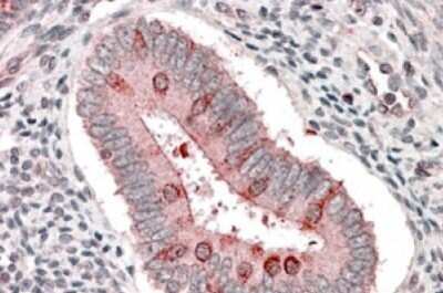 Immunohistochemistry-Paraffin: TSC1 Antibody [NB100-2821]