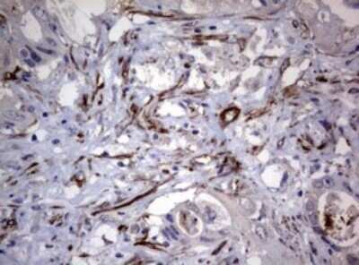 Immunohistochemistry: TSC1 Antibody (OTI3A2) - Azide and BSA Free [NBP2-74653]