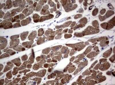 Immunohistochemistry: TSC1 Antibody (OTI3A2) - Azide and BSA Free [NBP2-74653]