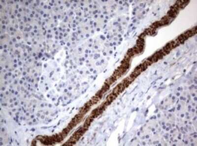 Immunohistochemistry: TSC1 Antibody (OTI3A2) - Azide and BSA Free [NBP2-74653]